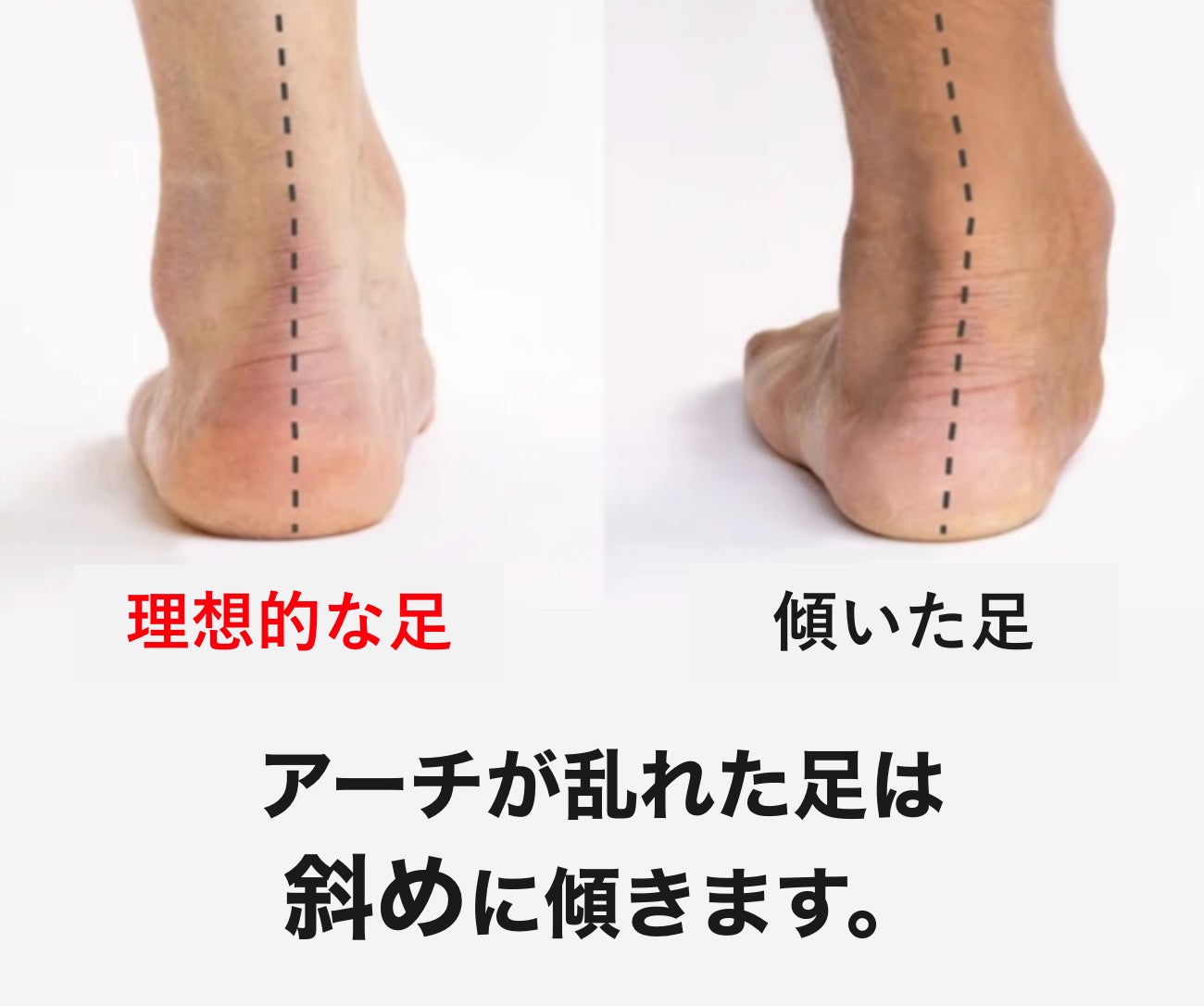 【歩行パフォーマンスを最大効率化】日本人の足に合わせて開発！姿勢改善型インソールがクラウドファンディングにて限定販売開始のサブ画像6